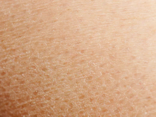 Clinisoothe+ and Dermatitis: How our award winning product can help with symptoms.