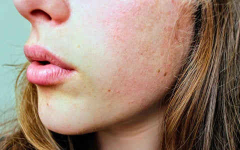 Everything You Need to Know About Your Skin Barrier